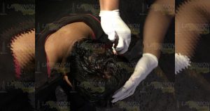 Borracho se abre la cabeza