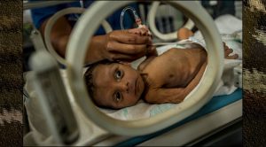 El hambre está matando a niños en Venezuela
