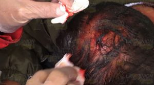 Fue golpeado durante un intento de asalto