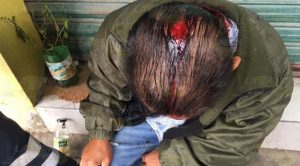 Fue golpeado durante un intento de asalto