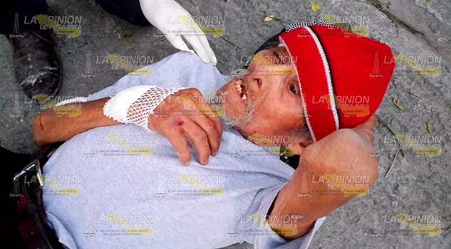 Hombre de 104 años sufre aparatosa caída Hombre Sufre Aparatosa Caída
