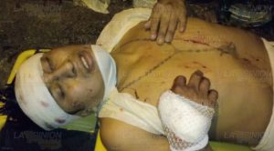 Su suegro lo macheteó cuando celebraban el inicio de año