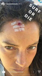 Sara Maldonado sufrió un accidente practicando su hobby favorito