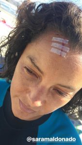 Sara Maldonado sufrió un accidente practicando su hobby favorito Sara Maldonado Sufrió Accidente