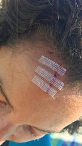 Sara Maldonado sufrió un accidente practicando su hobby favorito