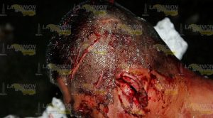 Herido a machetazos Herido Machetazos
