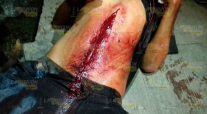 Acuchillado en la Unidad y Trabajo Acuchillado Unidad Trabajo