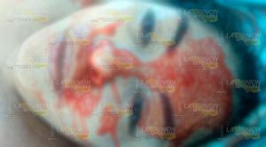 Muere mujer de balazo