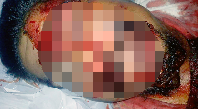 Baleado termina luego de discutir con amigos en borrachera