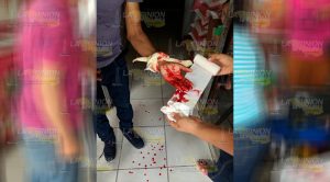 Joven se resistió a un asalto en Tuxpan y resultó herido Joven Resitio Asalto Tuxpan Resultó Herido