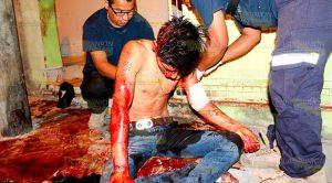 Compañero de farra lo agrede a navajazos en Papantla Compañero Farra AGrede Navajazos Papantla
