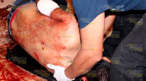 Compañero de farra lo agrede a navajazos en Papantla Compañero Farra AGrede Navajazos Papantla
