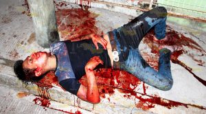 Compañero de farra lo agrede a navajazos en Papantla Compañero Farra AGrede Navajazos Papantla