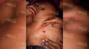 Sujetos atacan a obrero a puñaladas Sujetos Atacan Obrero Puñaladas