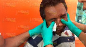 Ebrio pierde el equilibrio y se fractura la nariz Ebrio Pierde Equilibrio Fractura Nariz