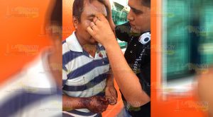 Ebrio pierde el equilibrio y se fractura la nariz Ebrio Pierde Equilibrio Fractura Nariz