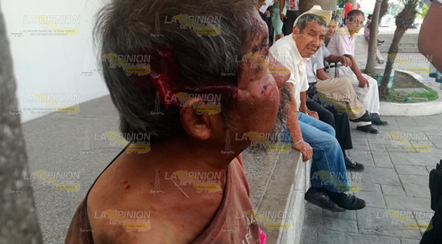 Ebrio sufre aparatosa caída en Tuxpan Ebrio Sufre Aparatosa Caída Tuxpan