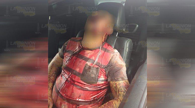 ¡Acribillado en Xalapa! Le dieron 19 balazos