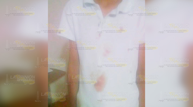 Taxista golpea a menor en Papantla
