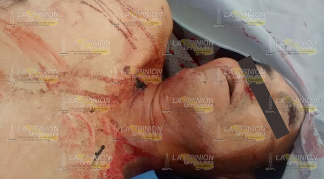 Asesino a su hermano a machetazos