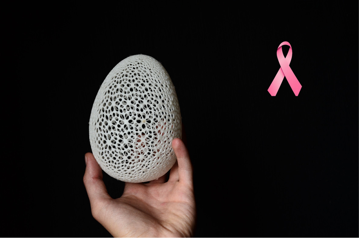 Prótesis mamarias en 3D: estudiantes de Guadalajara en México utilizan impresión 3D en pos mujeres que han tenido una mastectomía