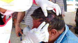 Escalera le cae encima y le abre la cabeza Escalera le cae encima y le abre la cabeza