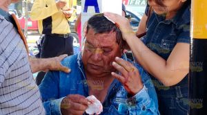 Escalera le cae encima y le abre la cabeza Escalera le cae encima y le abre la cabeza