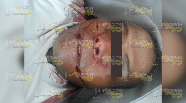 Ejecutan a conductor de auto bus en Jalpan