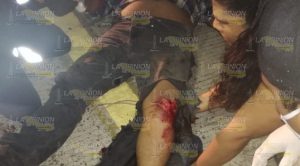 Motociclista embestido en la Tuxpan- Poza Rica