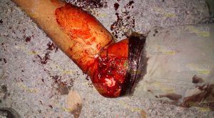 Casi se matan en la Chote - Agua Dulce Casi se matan en la Chote - Agua Dulce