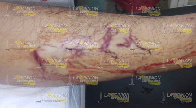 Lo apuñalan para robarle, se metieron a su casa