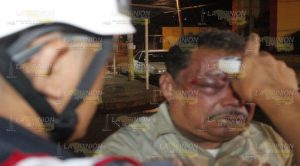 Taxista recibió tremenda golpiza por pasajero; en Coatzintla