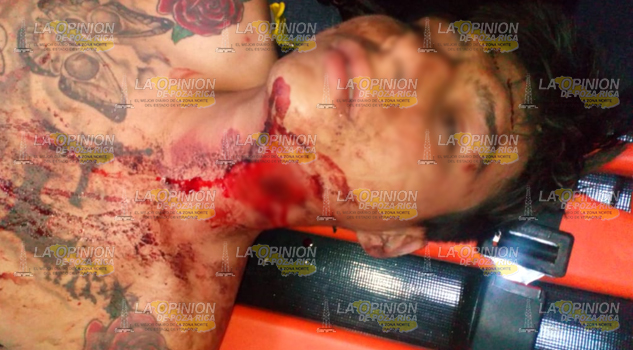 Joven es herido de un balazo en el cuello, en la localidad Estero del Ídolo en Álamo