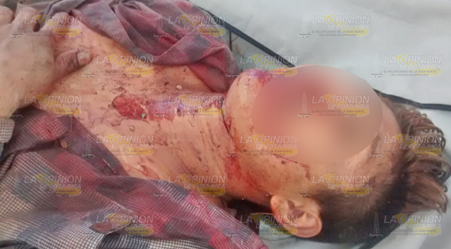 Asesinan a joven de al menos cinco navajazos durante riña