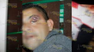 Tremenda golpiza le dieron a un parroquiano Tremenda golpiza le dieron a un parroquiano