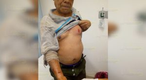 Padre e hijo fueron atacados por un perro Rottweiler