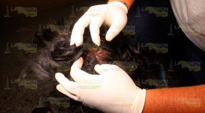 Mujer es atropellada por motociclista en la colonia Cazones Mujer es atropellada por motociclista en la colonia Cazones