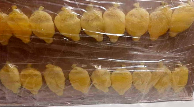 Le dolía el estómago en el aeropuerto, le sacaron 40 bolsas con cocaína