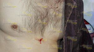 Herido con arma blanca en la colonia Miguel Hidalgo Herido con arma blanca en la colonia Miguel Hidalgo
