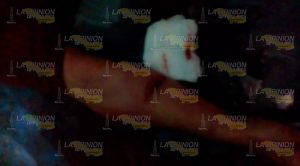 Hombre se corta la venas en Poza Rica y muere