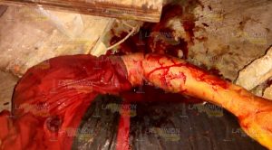 Hombre se corta la venas en Poza Rica y muere