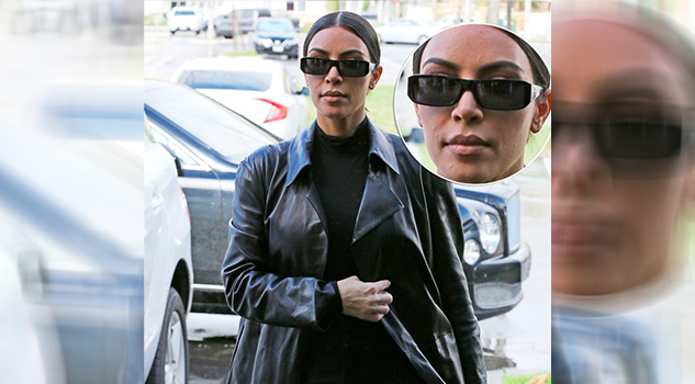 La psoriasis comienza a afectar el rostro de Kim Kardashian