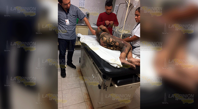 Abuelito resulta con quemaduras al incendiarse su colchón en Tuxpan