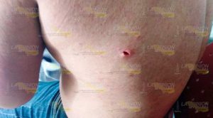 Agreden a navajazos a sujeto en Tlapacoyan Agreden a navajazos a sujeto en Tlapacoyan