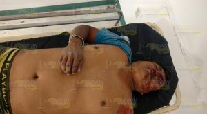 Motociclista ebrio derrapa sobre la carretera Álamo - Limonar Motociclista ebrio derrapa sobre la carretera Álamo - Limonar