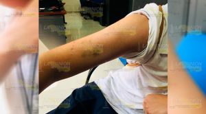 Estudiante de la UV es agredido a golpes por su vecina en Joloapan, Papantla Estudiante de la UV es agredido a golpes por su vecina en Joloapan, Papantla
