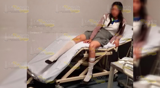 Estudiante fue atacada por perro en Jaltocán, Hidalgo Estudiante fue atacada por perro en Jaltocán, Hidalgo