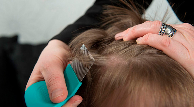 Piojos, riesgo permanente en escuelas; lo que los padres deben saber para prevenir el contagio