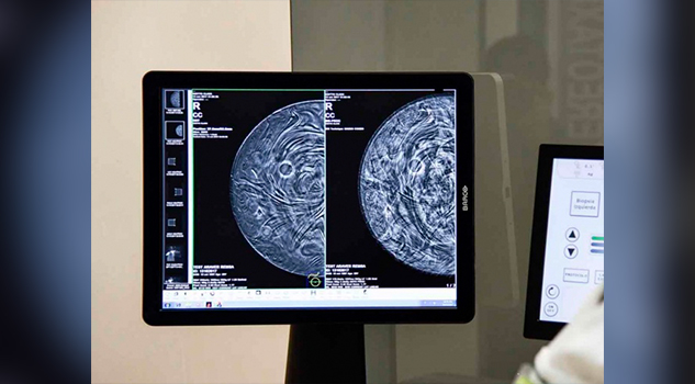Mujeres mexicanas participan en estudio contra cáncer de mama