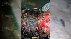 Golpean a comerciante de Chinampa de Gorostiza Intentan secuestrar a comerciante de Chinampa de Gorostiza